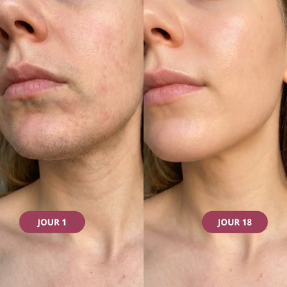 Rituel Trio Anti-Repousse Meloria
