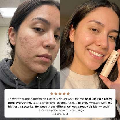 Acne Scar Remodeling Stick